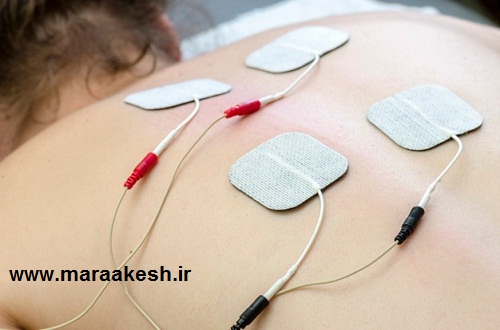 درمان کمر درد و دیسک کمر با استفاده از الکتروتراپی یا تنس الکتریکی