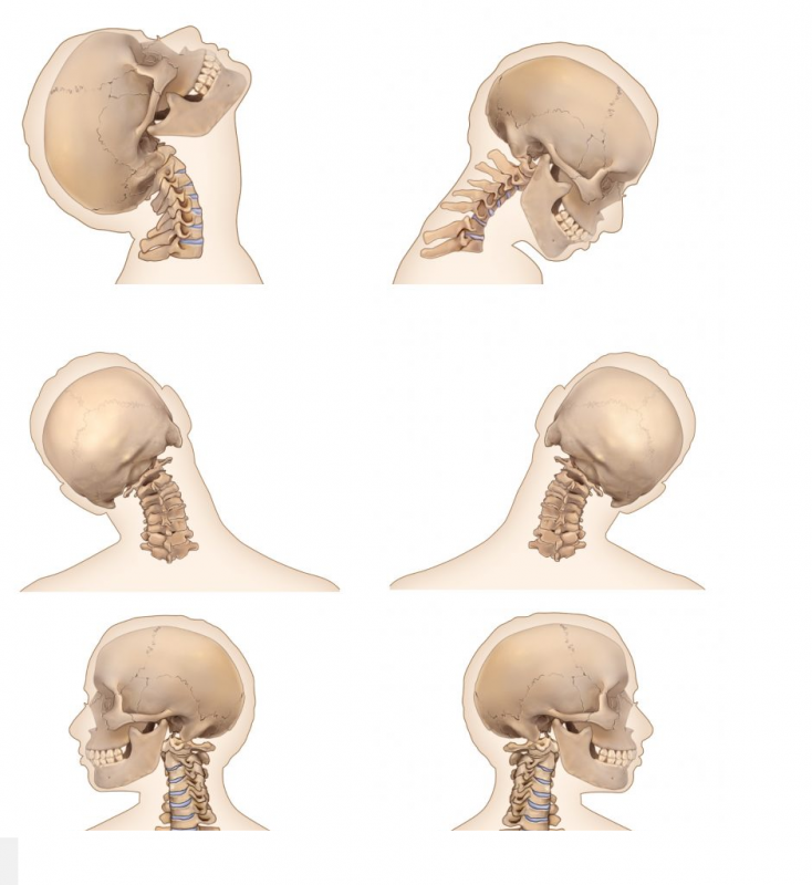 عوامل ایجاد دیسک گردن و علائم دیسک گردن